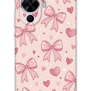 5802-huawei-nova-12s-kurdele-desenli-kilif