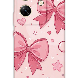 5803-infinix-zero-30-kurdele-desenli-kilif