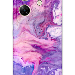 5813-infinix-zero-30-mermer-desenli-kilif