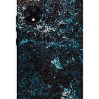 5819-huawei-nova-9-mermer-desenli-kilif