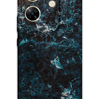 5819-infinix-zero-30-mermer-desenli-kilif