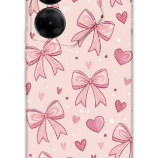 5802-tecno-camon-20-20-pro-4g-kurdele-desenli-kilif