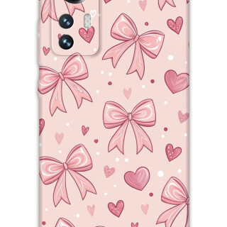 5802-xiaomi-mi-12-mi-12-pro-kurdele-desenli-kilif