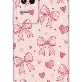 5802-xiaomi-poco-f4-kurdele-desenli-kilif