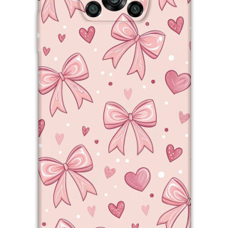 5802-xiaomi-poco-x3-x3-pro-kurdele-desenli-kilif