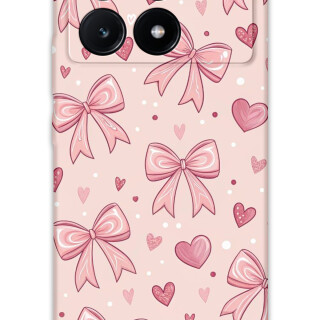 5802-xiaomi-poco-x6-pro-kurdele-desenli-kilif