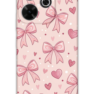 5802-xiaomi-redmi-13-kurdele-desenli-kilif