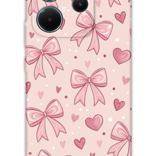 5802-xiaomi-redmi-note-14-4g-redmi-note-14-5g-kurdele-desenli-kilif