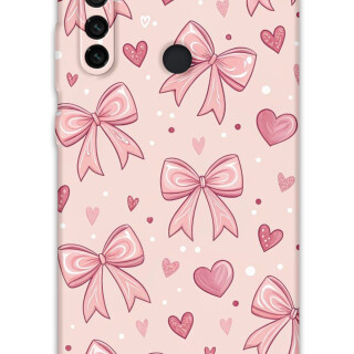 5802-xiaomi-redmi-note-8-kurdele-desenli-kilif