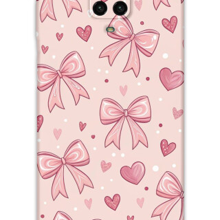 5802-xiaomi-redmi-note-9-pro-kurdele-desenli-kilif