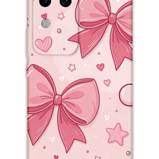 5803-vivo-v30-kurdele-desenli-kilif