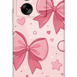 5803-xiaomi-mi-13t-mi-13t-pro-kurdele-desenli-kilif