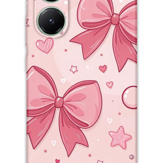 5803-xiaomi-poco-x7-pro-kurdele-desenli-kilif