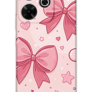 5803-xiaomi-redmi-13-kurdele-desenli-kilif