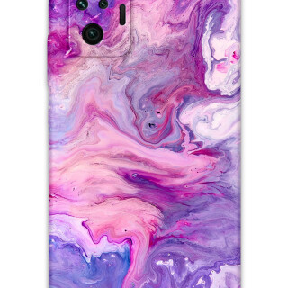 5813-xiaomi-redmi-note-10-pro-mermer-desenli-kilif