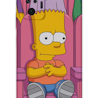 5820-xiaomi-redmi-note-10-pro-simpson-desenli-kilif