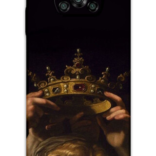 5833-xiaomi-poco-x3-x3-pro-retro-desenli-kilif