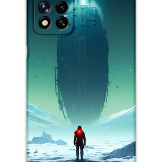 5864-xiaomi-poco-m4-pro-5g-note-11-pro-plus-5g-uzay-desenli-kilif