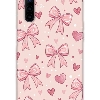 5802-realme-6-kurdele-desenli-kilif