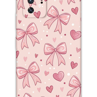 5802-xiaomi-poco-x3-gt-kurdele-desenli-kilif