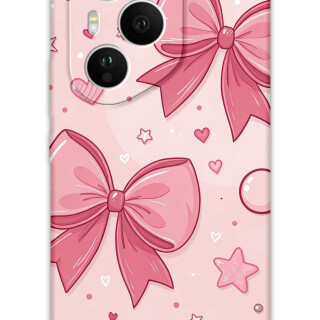 5803-huawei-honor-400-pro-kurdele-desenli-kilif