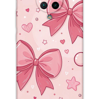 5803-xiaomi-poco-f2-pro-kurdele-desenli-kilif