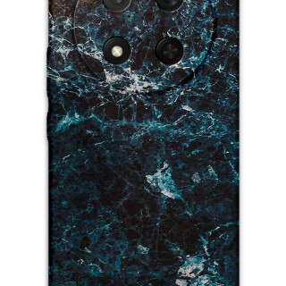 5819-huawei-honor-magic-7-lite-mermer-desenli-kilif