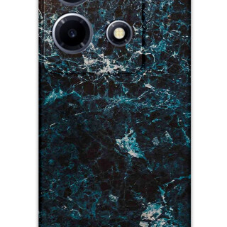 5819-infinix-note-30-vip-mermer-desenli-kilif