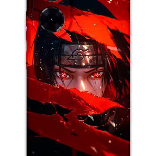 5874-xiaomi-redmi-a5-4g-itachi-uchiha-desenli-kilif