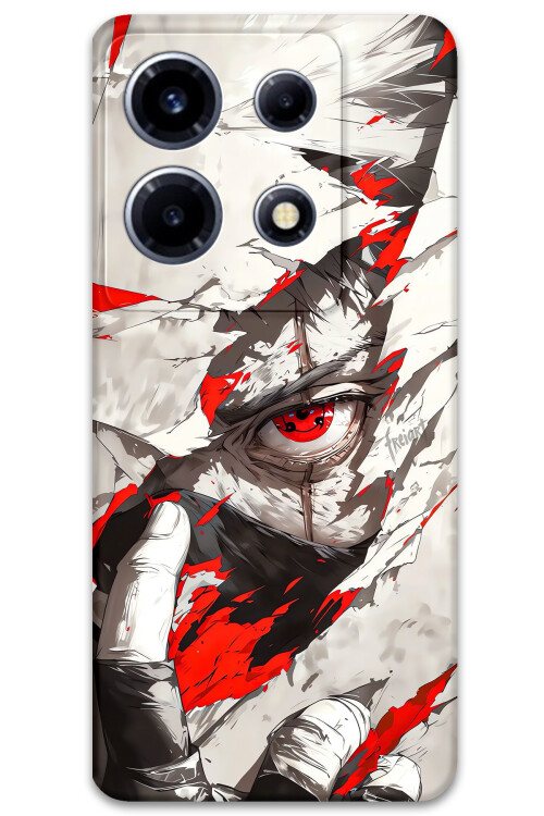 5876-infinix-note-30-vip-itachi-uchiha-desenli-kilif.jpg
