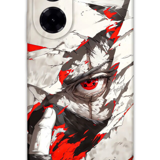 5876-xiaomi-redmi-a5-4g-itachi-uchiha-desenli-kilif