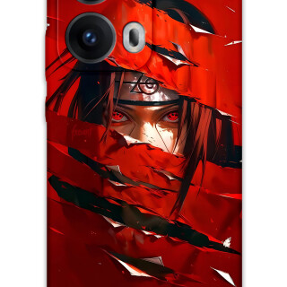 5885-oppo-reno-13-pro-5g-itachi-uchiha-desenli-kilif