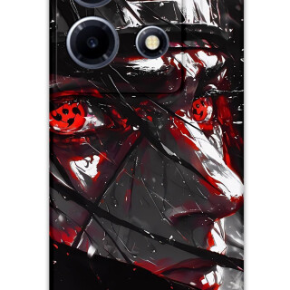 5886-infinix-note-30-vip-itachi-uchiha-desenli-kilif