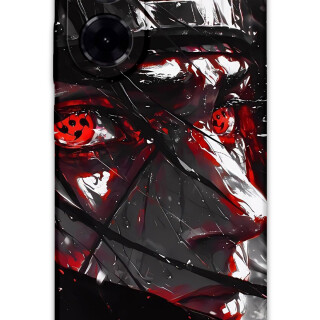 5886-xiaomi-redmi-a5-4g-itachi-uchiha-desenli-kilif