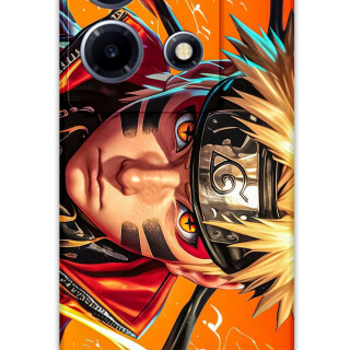 5911-infinix-note-30-vip-anime-desenli-kilif