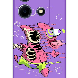 5939-infinix-note-30-vip-sponge-bob-desenli-kilif