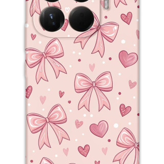 5802-xiaomi-mi-15t-pro-kurdele-desenli-kilif