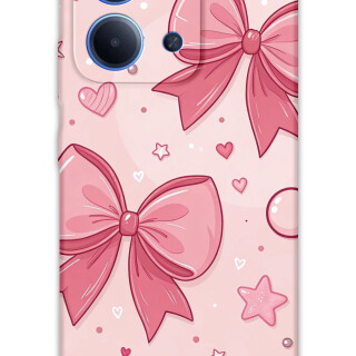 5803-xiaomi-redmi-15c-kurdele-desenli-kilif