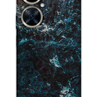 5819-huawei-nova-11i-mermer-desenli-kilif