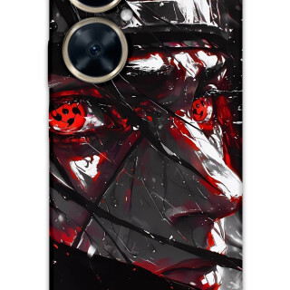 5886-huawei-nova-11i-itachi-uchiha-desenli-kilif