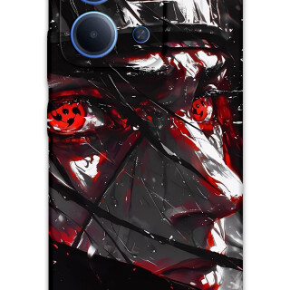 5886-xiaomi-redmi-15c-itachi-uchiha-desenli-kilif